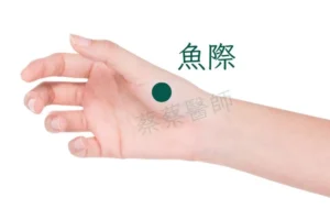 香港中醫治療喉嚨痛常用穴位圖 魚際