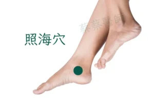香港中醫治療喉嚨痛常用穴位圖 照海穴