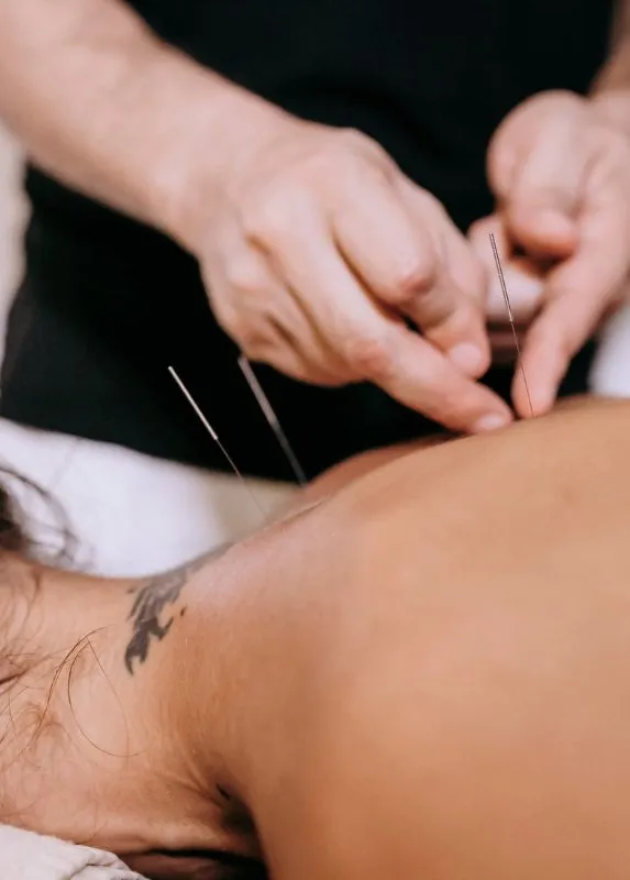 香港中醫針灸治療失眠