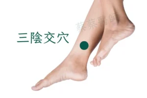 香港中醫治療失眠常用穴位圖 三陰交穴