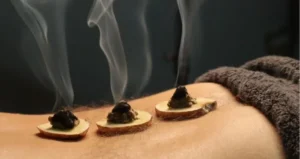 moxibustion